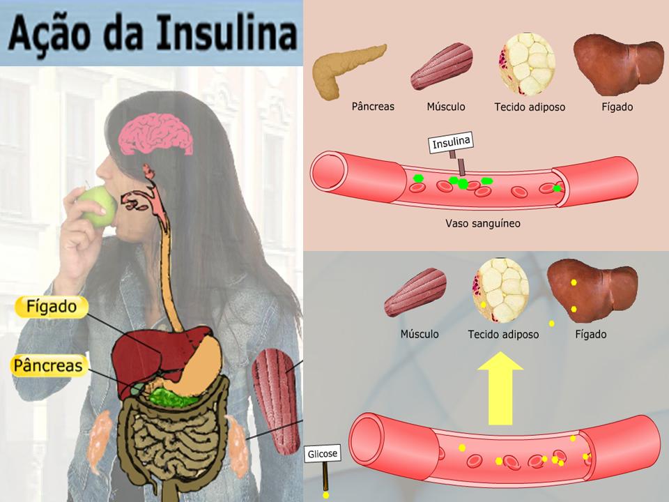 http://portaldoprofessor.mec.gov.br/storage/discovirtual/aulas/1846/imagens/acao_insulina.jpg